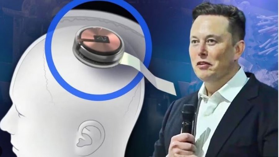 Ιησούς ο Musk, θα κάνει τους τυφλούς να βλέπουν! Εντός 2025 η τοποθέτηση του chip Blindsight για... υπεράνθρωπη όραση