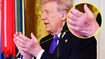 O Donald Trump αποκάλυψε τα αποτελέσματα των... ιατρικών του εξετάσεων