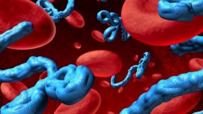 Ιός Ebola: Κρούσμα στην Ιταλία - Τέθηκε σε απομόνωση ο πολίτης που είχε ταξιδέψει στο Κονγκό