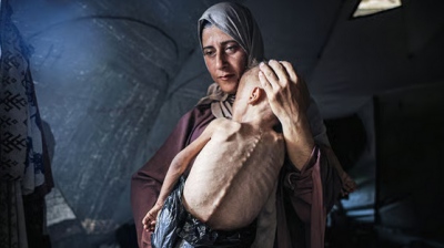 Κόλαφος ο διεθνής Τύπος κατά του Ισραήλ για τον λιμό στη Γάζα - Σοκαριστικές εικόνες