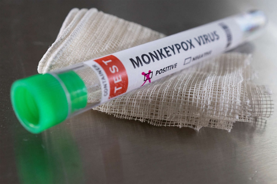 Συναγερμός στη Ρωσία - Έρευνες περί μόλυνσης από ευλογιά πιθήκων