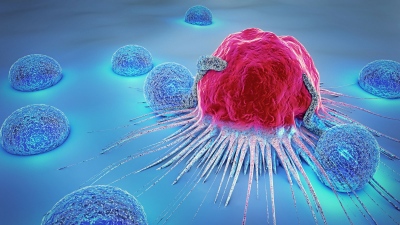 PET/CT: Πώς η σύγχρονη μοριακή απεικόνιση συμβάλλει στην έγκαιρη διάγνωση και παρακολούθηση του καρκίνου
